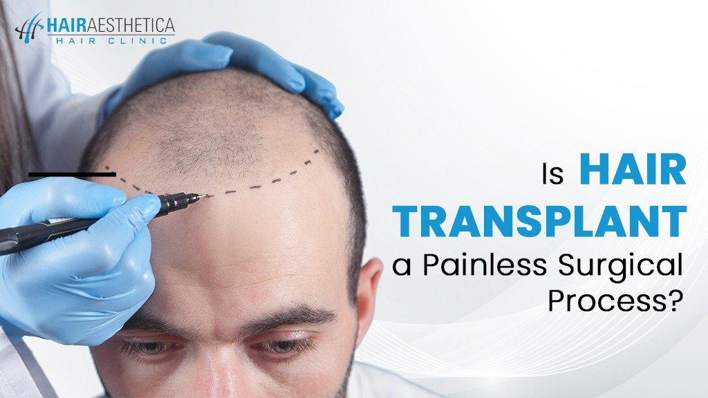 painless hair transplant surgery