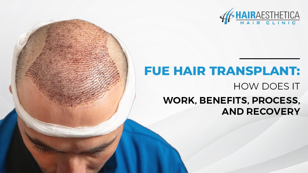 FUE Hair Transplant
